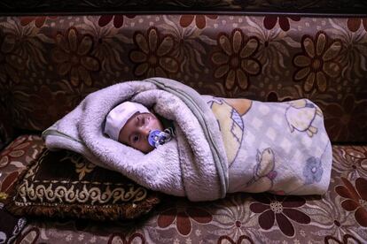 Karim, el niño herido durante el bombardeo al este de Guta, descansa en Duma (Siria).