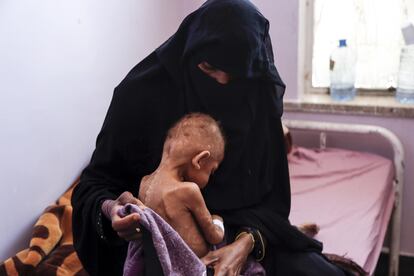 Una mujer abraza a su hijo desnutrido en el Hospital Materno Al Sabeen, en Sanaa (Yemen) el 13 de febrero.