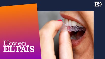 ‘Podcast’ | Por salud o por estética: ¿tú también llevas ortodoncia invisible?