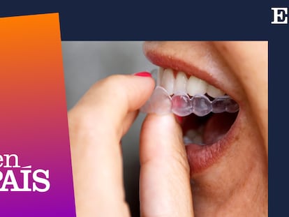 ‘Podcast’ | Por salud o por estética: ¿tú también llevas ortodoncia invisible?