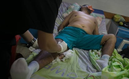 El m&eacute;dico de turno cura a un paciente en el Hospital del Periferico de Coche en Caracas.