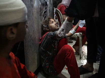 Una niña herida esperaba tratamiento en la sala de urgencias del hospital Al Shifa, este domingo.