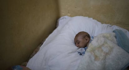 Jose Wesley, afectado por microcefalia, duerme en la cama de su madre en Bonito, estado de Pernambuco, Brasil (2016). 