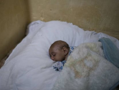 Jose Wesley, afectado por microcefalia, duerme en la cama de su madre en Bonito, estado de Pernambuco, Brasil (2016). 