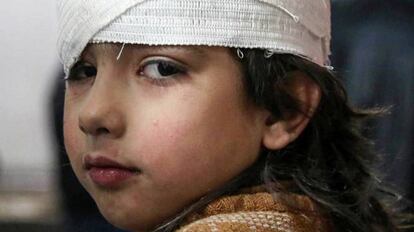IMÁGENES DEL DÍA. Una niña siria se recupera en un hospital en Kafr Batna tras ser herida durante un bombardeo en Guta Oriental (Siria), el 21 de febrero de 2018.
