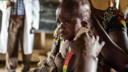 Un enfemero mide el perímetro braquial de un niño para saber si padece desnutrición en Mbau, RDC.