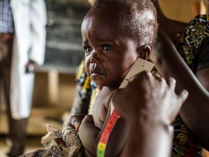 Un enfemero mide el per&iacute;metro braquial de un ni&ntilde;o para saber si padece desnutrici&oacute;n en Mbau, RDC. 