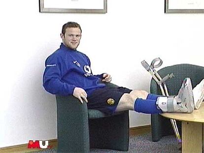 Rooney, con el pie escayolado.