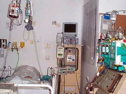 Aparatos para tratamiento de di&aacute;lisis hep&aacute;tica en el hospital La Fe de Valencia. 