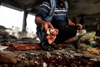 A man shows traces of blood at the school damaged by the Israeli attack in Nuseirat, in the Gaza Strip.