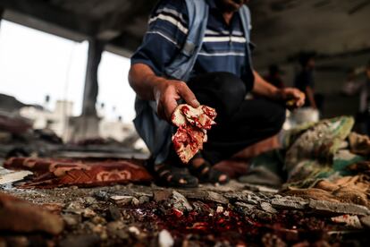 A man shows traces of blood at the school damaged by the Israeli attack in Nuseirat, in the Gaza Strip.