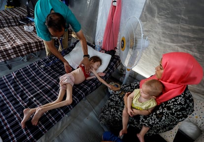 Un médico examina a Jana Ayad, una niña palestina con desnutrición, mientras recibe tratamiento en el hospital de campaña del International Medical Corps, en Deir al Balah, el 22 de junio. 