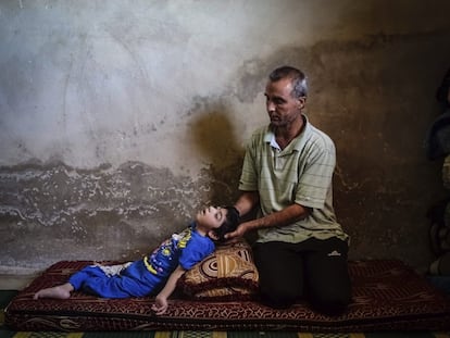 Ahmed sostiene a su hija Reem que subre discapacidad debido a diversas heridas de guerra en su casa en Daraa, Siria. 