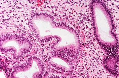 Cellular image of the endometrium.