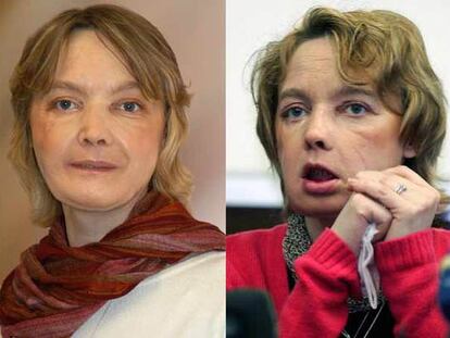 Los médicos confirman el éxito del primer trasplante de cara