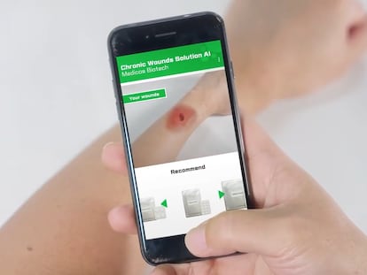 La aplicación 'Curesilk' analiza heridas y recomienda tratamientos.