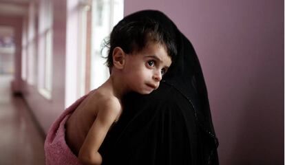 Una madre con su hijo desnutrido en un hospital de Saná (Yemen).