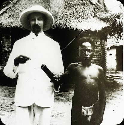 Un misionero señala a la mano cortada de un aldeano congoleño, símbolo de la brutalidad colonial, a principios del siglo XX.