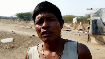 En una de las casas se encuentran tres hombres y una niña, uno de ellos es Evencio Camejo, el Cacique Mayor y líder de ese asentamiento, quien llegó junto a su comunidad hace dos años a la ciudad buscando mejorar la calidad de vida. Pero no le ha sido fácil: “Huimos de nuestras tierras porque no se consigue nada, allá no hay nada, allá uno sufre bastante, no hay arroz, no hay nada, uno come gusanos y plátanos, por eso nos vinimos acá, aquí podemos comprar pollo de vez en cuando y algo de comida con lo poco que conseguimos".