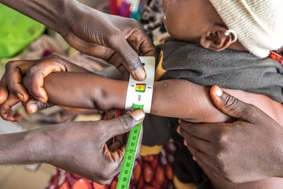 El aumento de la pobreza, la desigualdad, los conflictos, las catástrofes relacionadas con el clima y las emergencias de salud, como la pandemia, están contribuyendo a provocar una crisis nutricional entre los niños de corta edad que apenas ha dado señales de mejora en los últimos diez años. Así se desprende del último informe de Unicef 'La crisis de la alimentación infantil en los primeros años de vida', publicado en vísperas de la Cumbre sobre los Sistemas Alimentarios de las Naciones Unidas, celebrada el pasado jueves 23. En la imagen, un médico realiza la prueba de medición del perímetro braquial para identificar a los niños de entre seis meses y los cinco años que padecen malnutrición.