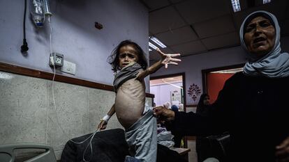 Una niña con desnutrición en el hospital de Deir al Balah (Gaza), el 31 de mayo.