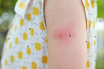 Solo pican las hembras porque los mosquitos necesitan la sangre para reproducirse, no para alimentarse.