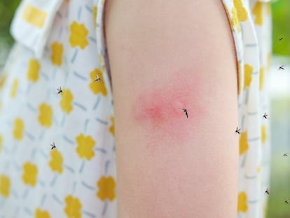 Solo pican las hembras porque los mosquitos necesitan la sangre para reproducirse, no para alimentarse.