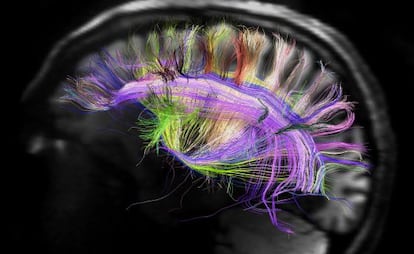Imagen del cerebro que muestra las curvas de fibras neuronales.