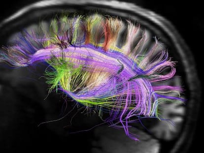 Imagen del cerebro que muestra las curvas de fibras neuronales.