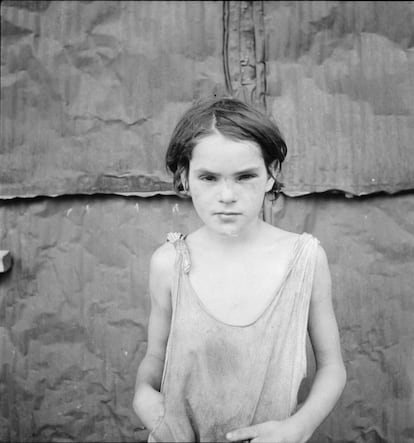 Niña herida, Shacktown, Elm Grove, Oklahoma, 1936