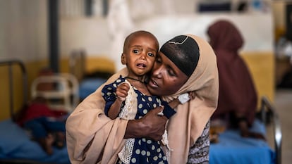 Una madre y su hija en el Hospital Trocaire en Dollow, Somalia, que trata la desnutrición infantil.