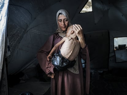 Fotografía hambre en Gaza