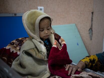 Guldana, de dos años, está desnutrido. Le atienden en el hospital Indira Gandhim en Kabul, Afganistán, el lunes 8 de noviembre de 2021. El número de personas que viven en Afganistán en condiciones cercanas a la hambruna ha aumentado a 8,7 millones, según el Programa Mundial de Alimentos.