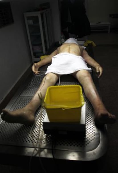 The cadaver dissection room at the Complutense’s faculty of medicine.