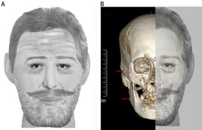 Reconstrucción digital de la cabeza momificada de Henri IV (derecha) y el rostro del monarca (izquierda).