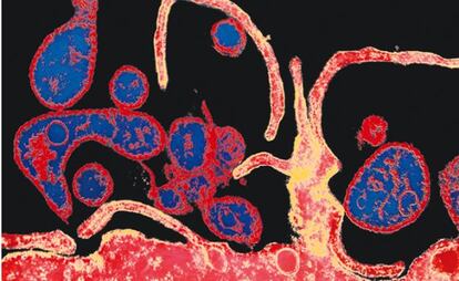 Imagen de un virus infectando una c&eacute;lula.