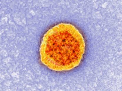 Imagen tomada con un microscopio del virus de la hepatitis C.