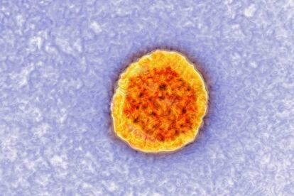 Imagen tomada con un microscopio del virus de la hepatitis C.