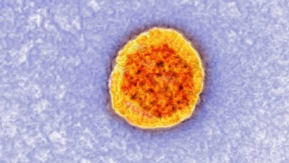 Imagen tomada con un microscopio del virus de la hepatitis C.