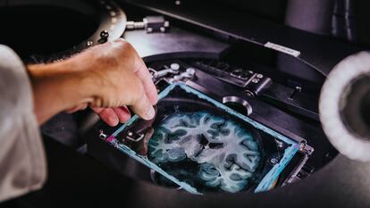 Corte del cerebro humano en un microscopio especial para visualizar fibras nerviosas, en un laboratorio alemán.