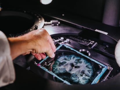 Corte del cerebro humano en un microscopio especial para visualizar fibras nerviosas, en un laboratorio alemán.