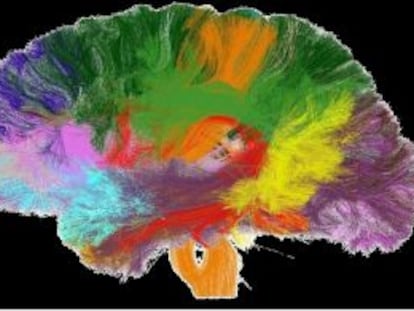 Lo último en cerebros de silicio