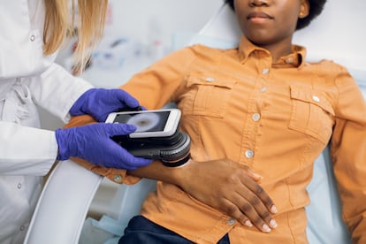 En España, se estima que en 2025 habrá cerca de 9.400 casos de melanoma.
