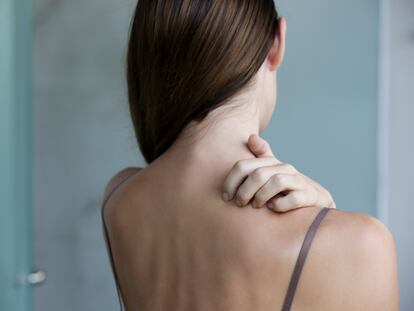 Una mujer que padece psoriasis se rasca la espalda por las lesiones que provoca esta enfermedad inflamatoria.