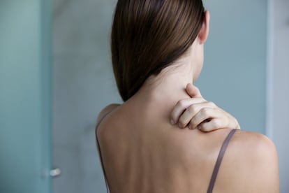 Una mujer que padece psoriasis se rasca la espalda por las lesiones que provoca esta enfermedad inflamatoria.