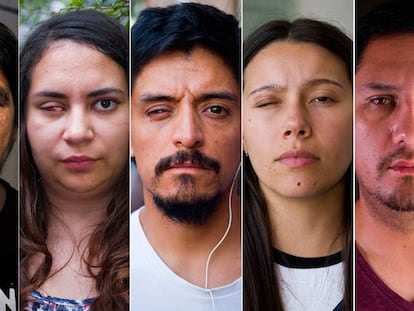 Las víctimas de la violencia policial en Chile