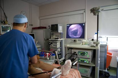 Proceso de realización de una endoscopia.
