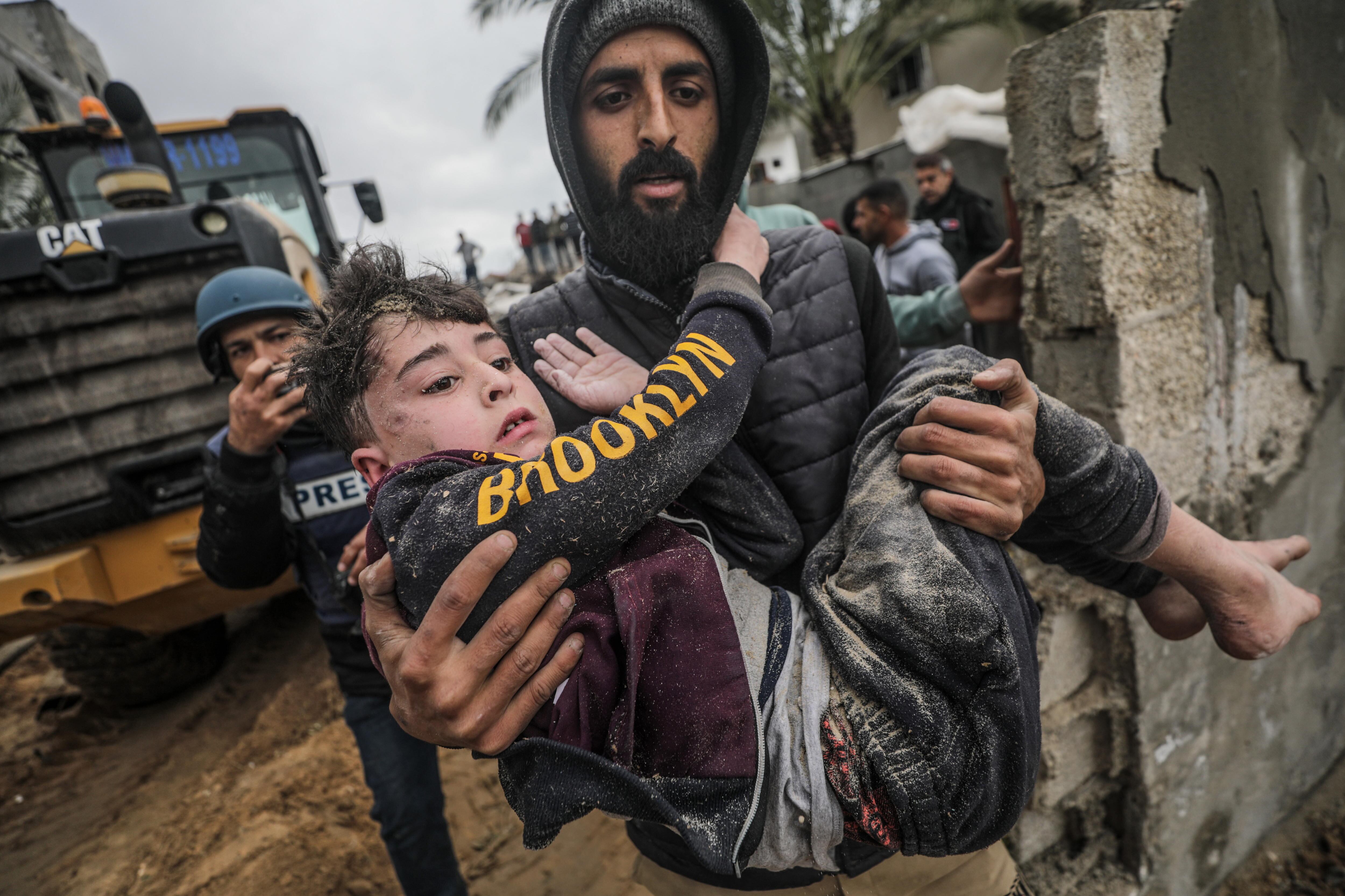 Casi la mitad de los heridos por balas y metralla en la cabeza en Gaza son menores