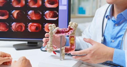 Un médico explica a un paciente el estado de su cáncer colorrectal tras una colonoscopia.