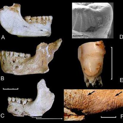 Fósiles neandertales de El Sidrón (Asturias), incluida una mandíbula con marcas de corte de prácticas caníbales (abajo a la derecha).